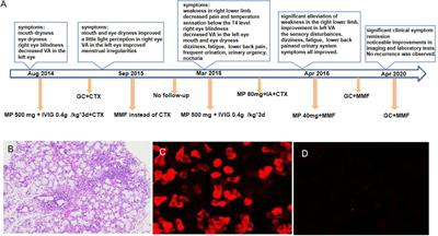 Protein-A immunoadsorption combined with immunosuppressive treatment in refractory primary Sjögren’s syndrome coexisting with NMOSD: a case report and literature review